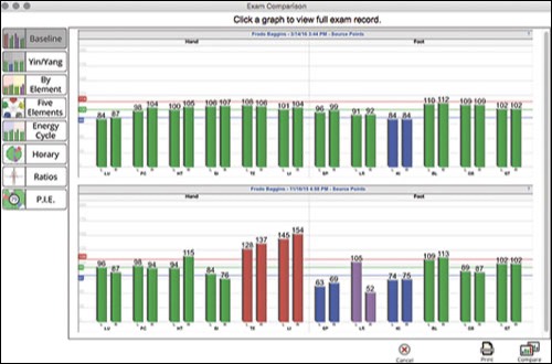 Instant clarity with color-coded Qi-Mapping reports